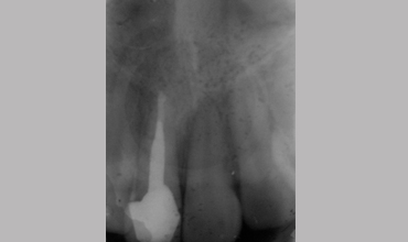 Preventative dentistry treatment in Anand                    